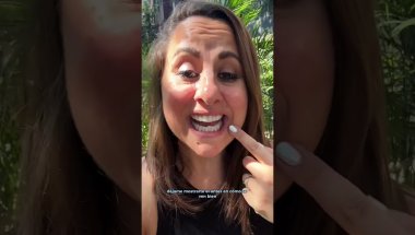 1.5 Years Later… My Invisible Retainers Are DONE! 🦷 | Dental Journey in Medellín