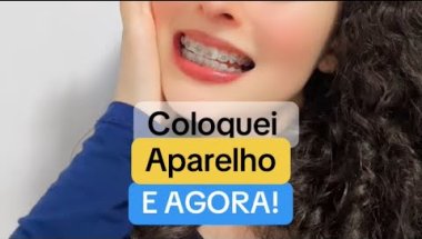 Coloquei aparelho e agora! VLOG | Jéssica Lombardi