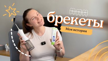 Брекеты в Ташкенте: установка, цены и приборы для ухода