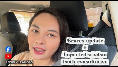 Braces Adjustment + Impacted Wisdom Tooth Consultation Vlog | Lovely Llamoso