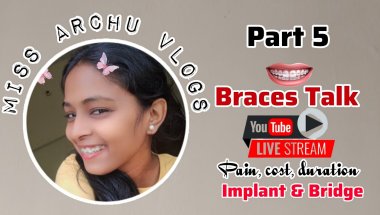 😍🦷 Miss Archu Vlogs  is live! || Part 5 all about Braces cost pain & Time #trending