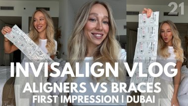 Starting Invisalign In Dubai | First Impression + My Braces Story