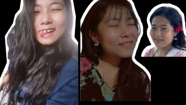 Huge Teeth Gap and Braces Journey 😬