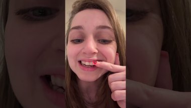 Shauna Rae: Invisalign Day 4