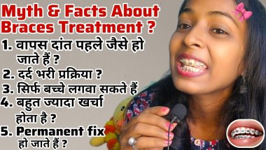 😳 क्या Braces से जुड़ी ये बातें सच होती हैं ? Myth & Facts About Braces | Pain ❤️‍🩹 Cost ₹ Journey