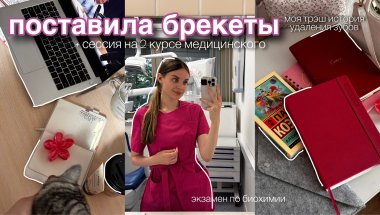 я поставила брекеты *моя история лечения зубов* + летняя сессия в медицинском🦷