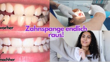 VLOG| Zahnspange ist endlich raus!! PR Packet unboxen von Teletrogy+ einkaufen