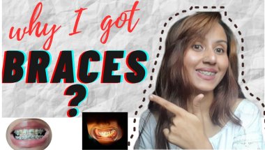 What Made Me Get Braces🦷! My braces journey #braces #mybracesjourney #bracesjourney #viral #trending