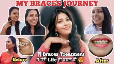 MY BRACES JOURNEY ll 🦷Braces Treatment ने मेरी Life ही बदल दी 😍 / Profile Improvement With Braces