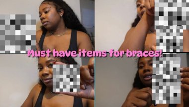 😱Must have items for braces! 😱These items have made having braces a breeze!
