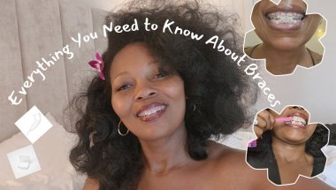 Are You Getting Braces For The First Time? Everything You Need To Know| Adults Get Braces Too 🪥✨