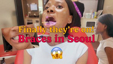 Getting Braces in Seoul South Korea