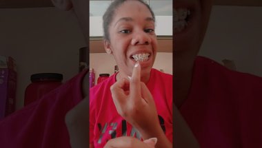 FUI COLOCA APARELHOS NO DENTE E OLHA O QUE ACONTECEU 😬😱