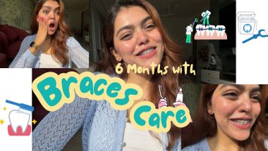 TIPS🦷Do’s and Don’t while *BRACES*on🪥 #braces #trending #bracestreatment #explore #viral