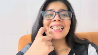 🦷🤑😱Braces lagwane se pehle  jan lo ye sb baate Cost /Time /pain #tranding #dentist #top #viral #vlog