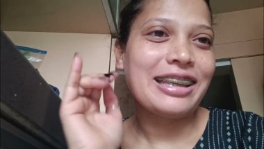 Braces last month 😇😇@sandhyatiggavlog8809  #bracestransformation
