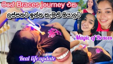 ලස්සන සිනහවක් 🌸 |ලස්සනට ඉන්න කැමති ඔයාලට 😍|Magic of braces 🦷| Beauty tips |ලස්සන රහස් ✨