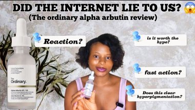 THE ORDINARY ALPHA ARBUTIN SERUM REVIEW (Honest, Raw & Unfiltered)