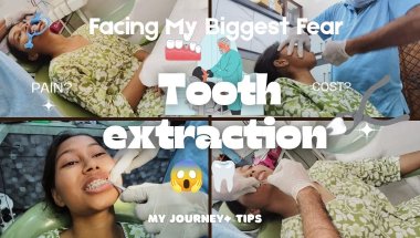 First Time TOOTH EXTRACTION 😁| Braces Journey + Tips  #braces #bracestreatment #dentist #dentalcare