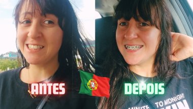 Colocando Aparelho pela Primeira Vez em Portugal | Dói? Preço? Experiência Real #afamilianery