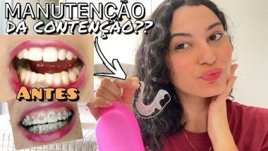 TIREI O APARELHO ORTODÔNTICO DEPOIS DE QUASE 2 ANOS | CRIS MARIA