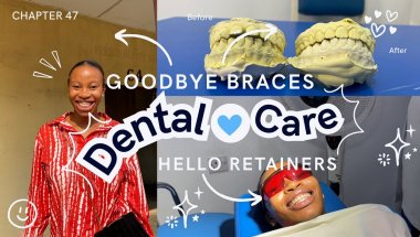 Finally Taking Off My Braces | Transitioning to Retainers 🦷✨