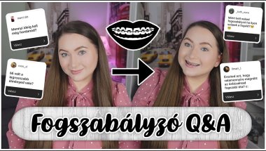 FOGSZABÁLYZÓ UPDATE - LASSAN 1 ÉVE FENT! 👄👀 // KLAUDIA