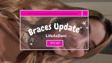 Braces Update😁
