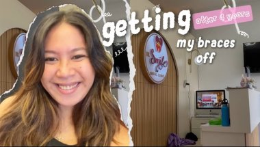 Finally! Getting My Braces Off | Theresse Rocina