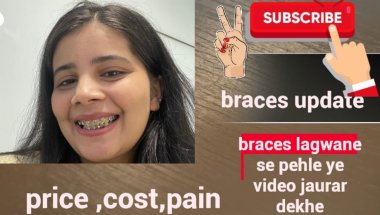 Braces update🦷🤑😱 #vlog tranding #viral #top #vlog #viralvideo #virwlshorts #dentist