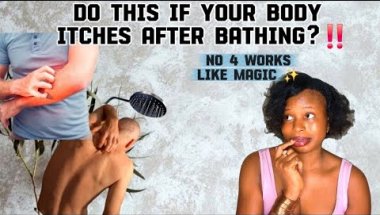 6 Effective Ways to Stop Itchy skin After a Shower or Bath  (No 4 is how i got rid of mine)
