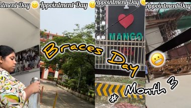 ||Dentist Appointment || Braces Journey || मेरे दाँतो में लगा रब्बर ताकि दाँत शेप में आ सके ।।
