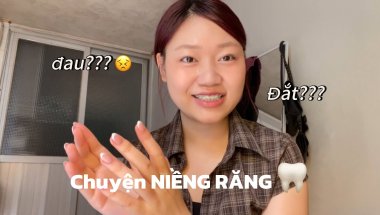 NIỀNG RĂNG tuổi 22 ??? Đau đớn? Đắt đỏ? Khó khăn?