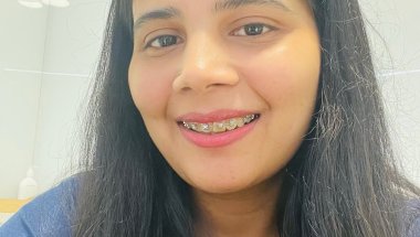 Braces update🦷😨 #tranding #viral #description #viral #top#viralvideo #viralshorts