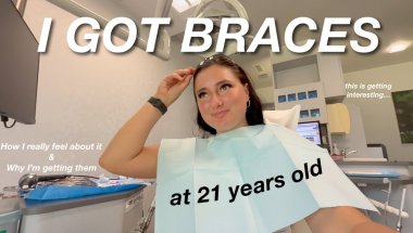 I GOT BRACES... (at 21 years old) | Kylie Rinna