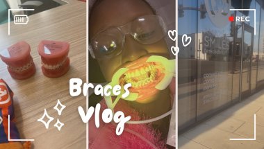 Come with me to get a Braces vlog