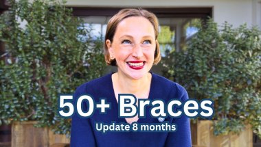 50+ Braces - My Update after 8 Months