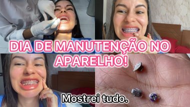Manutenção no aparelho ortodôntico | bracket | mostrei tudo