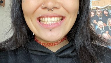 NEW SMILE/ BRACES OFF AFTER 3YRS/RETAINERS FOR THE REST OF MY LIFE?