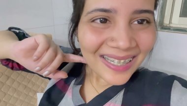 6Month braces update#description #viral #viralvideo #viralshorts #vlog #dailyvlog #tranding #top