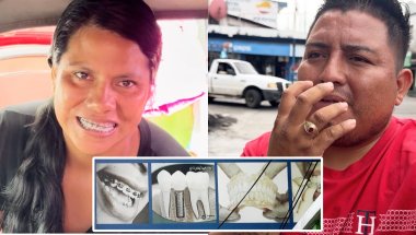 6 Am Sacamos A Mi Esposa Con Dentista Se Le Quebraron Los Brackers En Pleno Desayuno