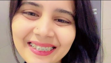 My 🦷🤑1st month braces experience price, time ,pain #viral #tranding #vlog #viralvideo description #