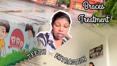 || Braces Treatment || My First Time Teeth Extraction || How I Spend The Day || My Braces Journey ||