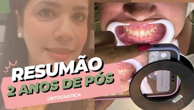 2 Anos de Ortognática - Resumo da Melhor Decisão da Minha Vida