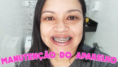 VLOG; MANUTENÇÃO DO APARELHO ORTODÔNTICO | POLÍANA BERNARDO #vlogs