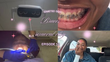 Vlog: REMOVING MY BRACES AFTER 9 YEARS| STORY TIME ON WHY I GOT THEM