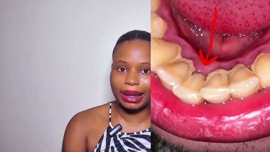 How to Get Rid of Mouth odor For Good (Fast and Effective Tips)