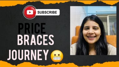 Braces journey 😱🦷#viral #vlog #trending #minivlog #viralvideo #viralshorts #top #trendingshorts l
