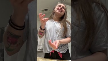 Shauna Rae: Invisalign Day 34