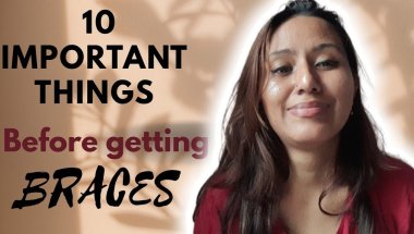 Things I Wish I Knew Before Getting Braces (Must-Watch!) My braces journey #braces #bracesjourney